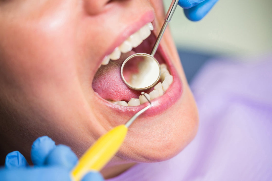 The Link Between Dental Plaque and Gum Disease - Enzim Singapore
